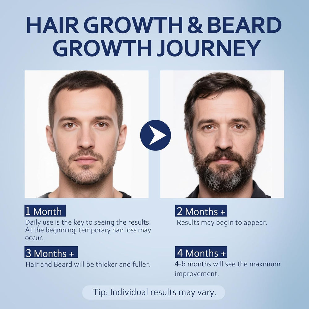 5% Minoxidil Hair Growth Serum for Men & Women with Biotin: Minoxidil for Men and Women, 5 Percent, Hair Regrowth Treatment, Extra Strength (12 FL OZ, Dropper 6)